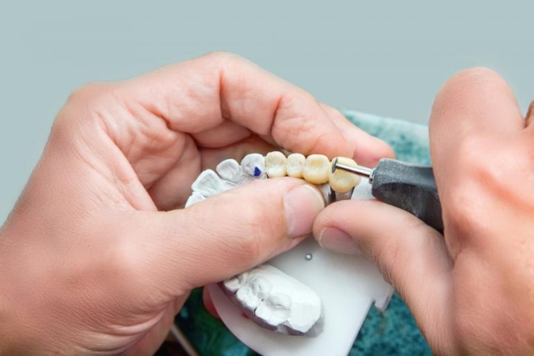In quattordici comuni dell’Ambito N23, dentiere gratis a chi non le può acquistare