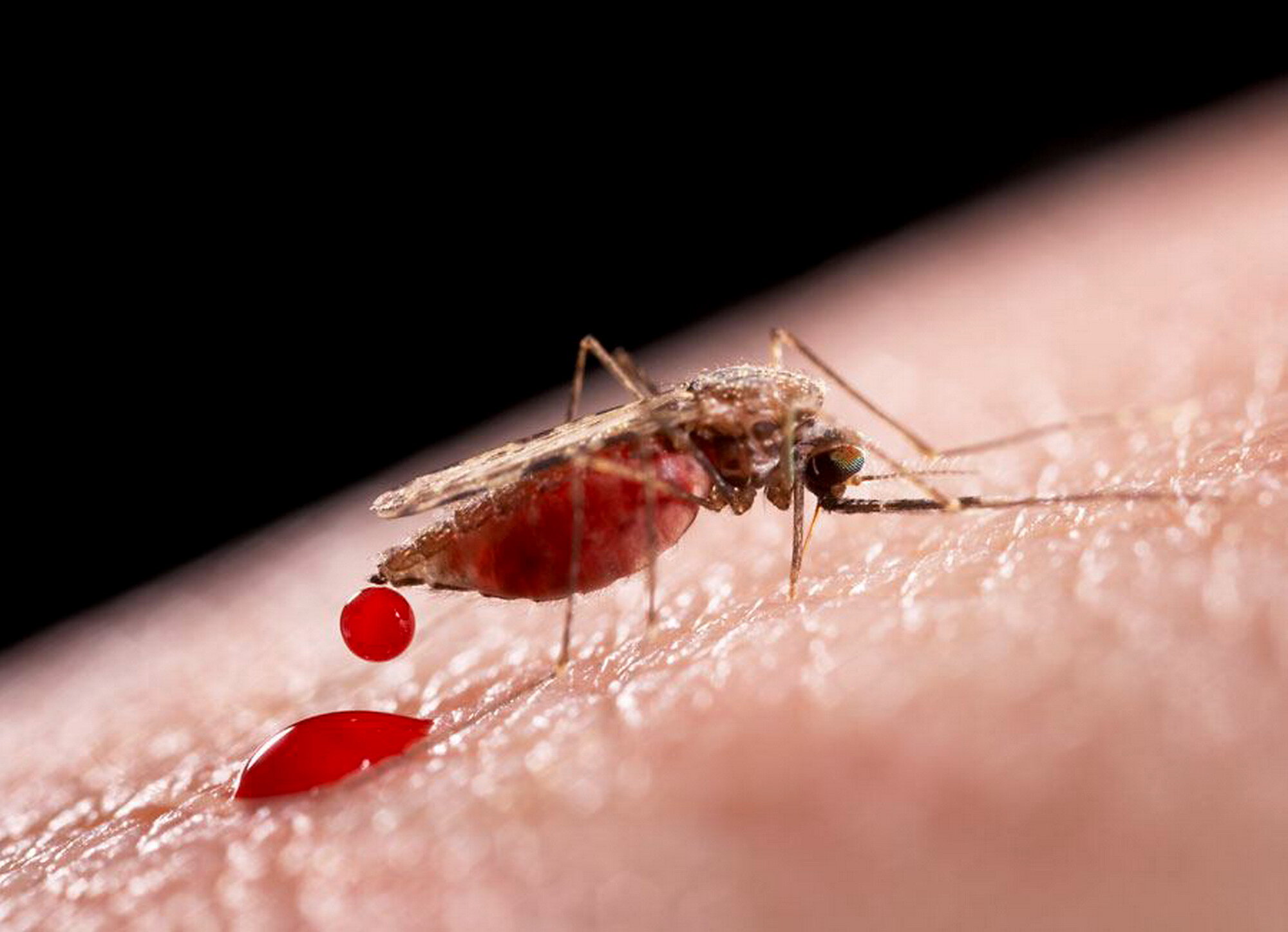 Zanzare portatrici del virus Chikungunya: bloccate le donazioni di sangue ad Anzio