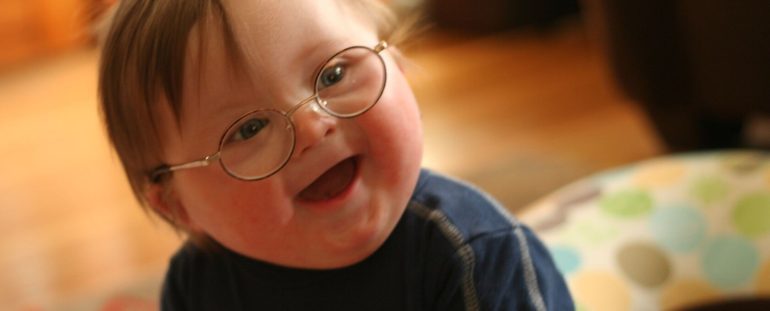 Sei single? Puoi adottare un figlio solo se affetto dalla Sindrome di Down