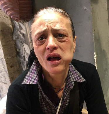 Donna senzatetto vittima di una baby gang a Napoli: “Portatemi via da qui”