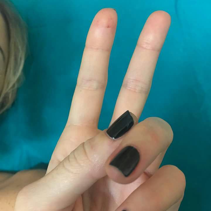 La ‘Iena’ Nadia Toffa su facebook: ”Ho preso una bella botta, ma tengo duro”