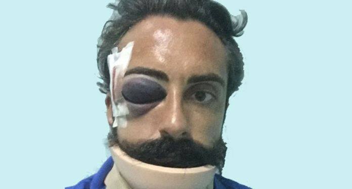 Agropoli: Pascuccio in ospedale, colpito e fiero