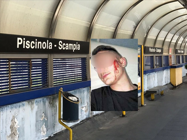 Napoli, sfregiato a 16 anni per rubargli il cellulare posta la foto su Fb, la mamma: ‘Meglio far conoscere queste oscenità’