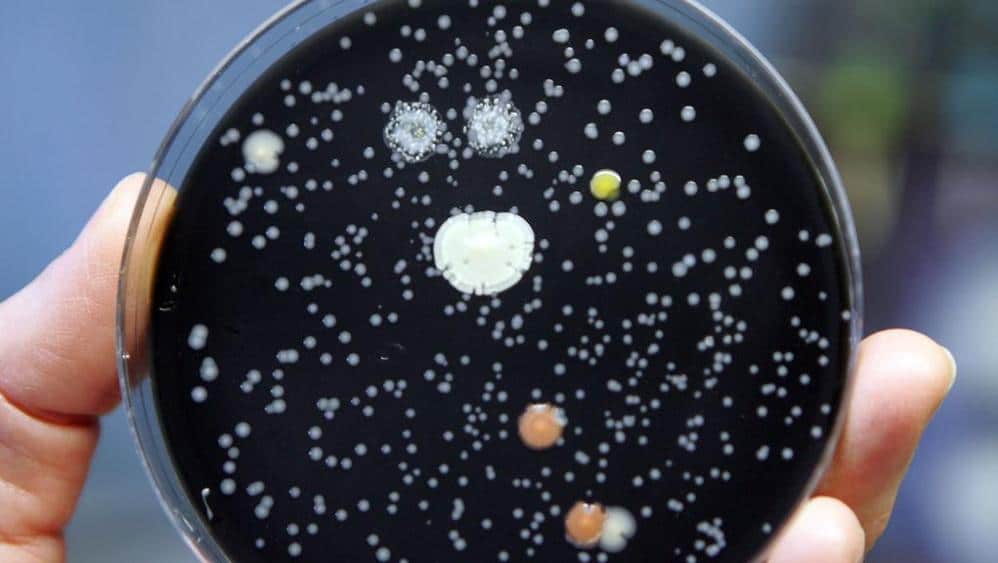 Legionella: salgono a 40 le persone contagiate, 7 nuovi casi