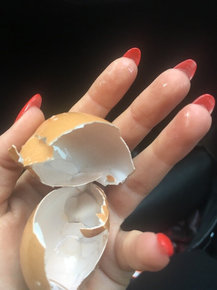 Napoli, lanciano un uovo da un’auto: giovane avvocato ferita a un occhio