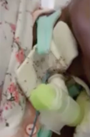 Napoli, donna intubata ricoperta di formiche in ospedale. IL VIDEO DELLA VERGOGNA
