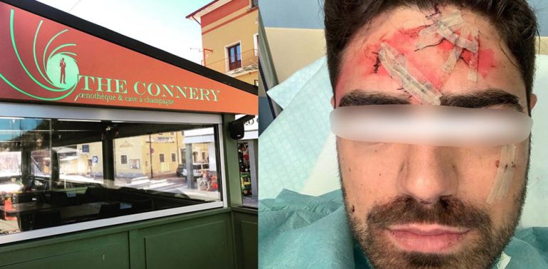 Giovane napoletano ferito con un bicchiere in una discoteca di Roccaraso