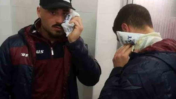 Calciatori picchiati dai tifosi davanti agli spogliatoi a Fratta: il Mondragone si rifiuta di giocare nella ripresa