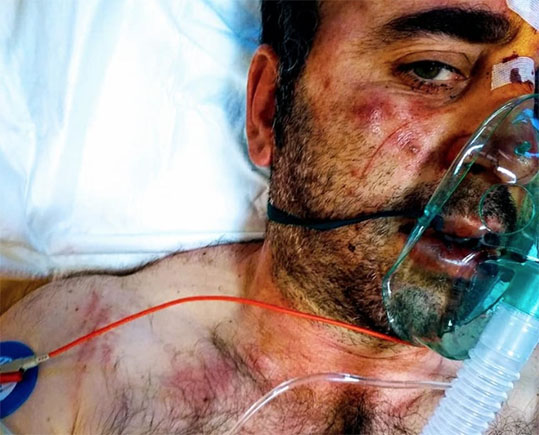 Rapinato e picchiato a sangue in provincia di Firenze, commerciante salernitano riceve la solidarietà di Salvini