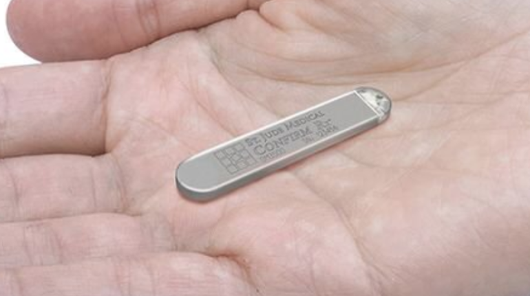 micromonitor cardiaco-napoli