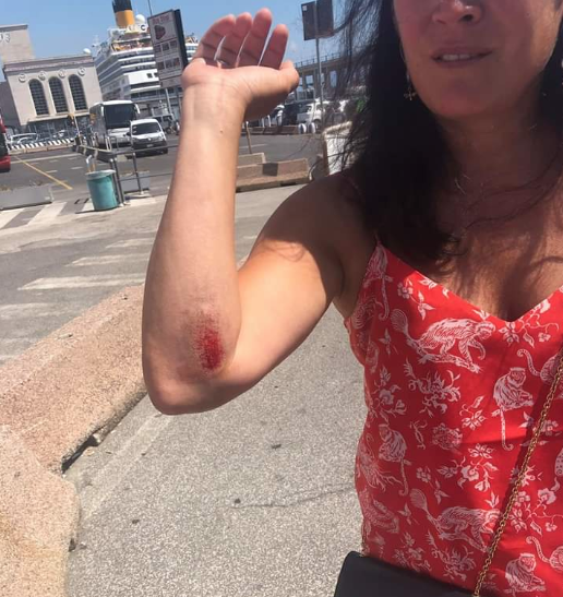 Napoli, turista ferita e scippata all’interno del porto