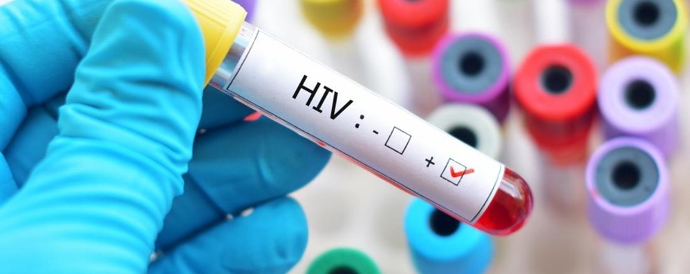 Aids: scoperto nuovo ceppo Hiv dopo 19 anni