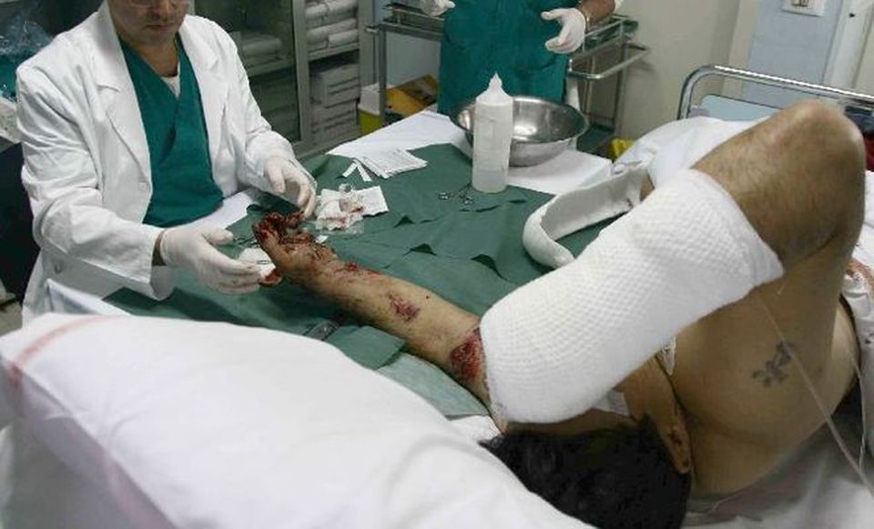 Napoli, rom all’ospedale Pellegrini con ‘sfacelo traumatico’ alle due mani a causa dei botti