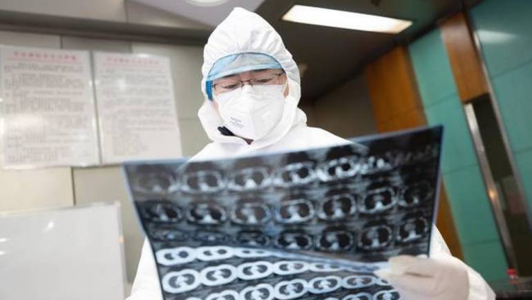 Coronavirus, attesi domani a Pratica di Mare 9 italiani da Wuhan In tutto saranno 13 i cittadini europei che giungeranno in Italia