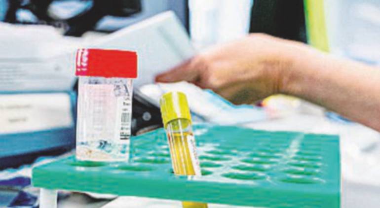 Ascierto: ‘Il Tocilizumab in pazienti intubati funziona poco’