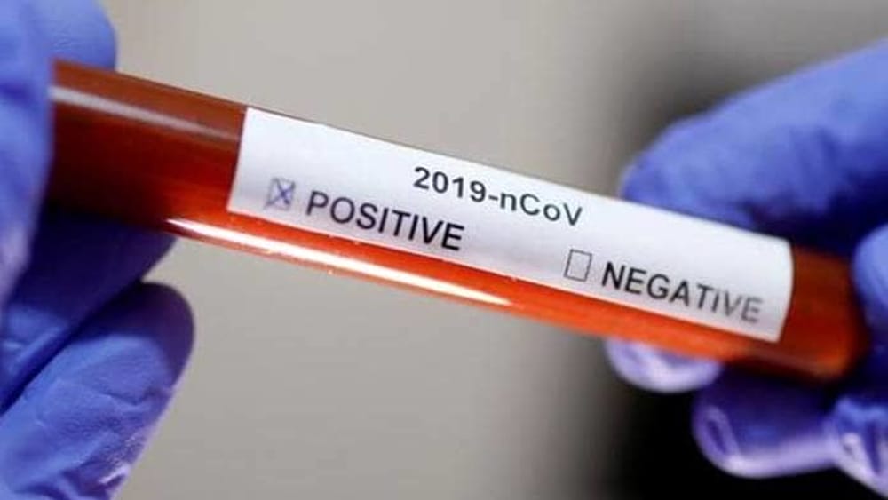 Emergenza Coronavirus, 318 positivi in piu’ nel Casertano