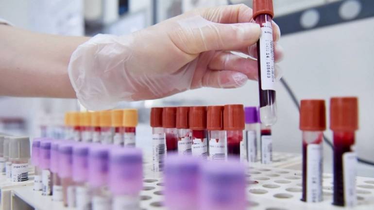 Napoli, 23 studenti positivi al covid nelle ultime 24 ore