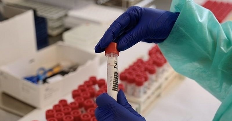 Covid-19: record di casi ad Eboli, nuovi contagi in altri otto comuni