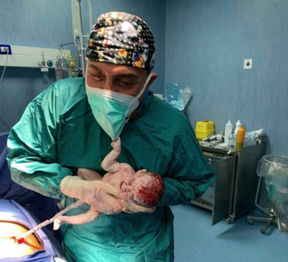 Castellammare, virale suo web la foto delle neonata che tenta di strappare la mascherina al medico