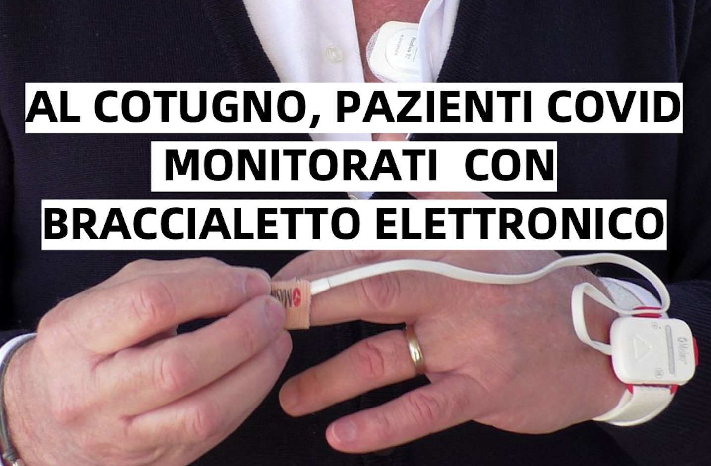 Napoli, al Cotugno pazienti covid monitorati con bracciale elettronico