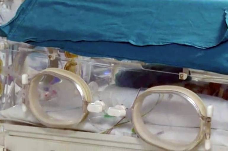 Nola, muore bimba nata prematura: 3 medici indagati per omicidio colposo