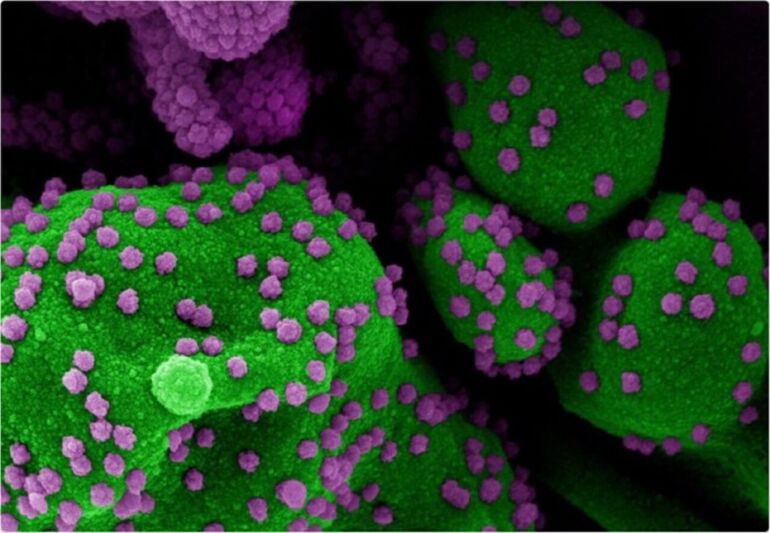 In Russia compare la nuova variante del coronavirus AY.4.2