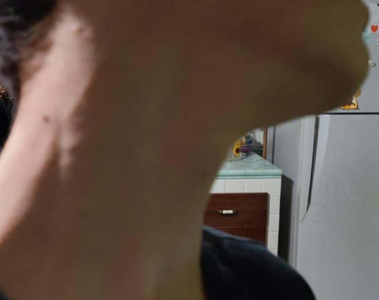 Quarto, all’ex Ipercop baby bullo con la sua gang semina il terrore tra i coetanei