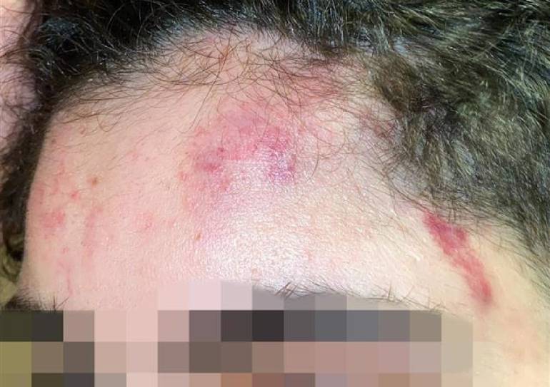 Orinano in un vicolo, ragazzi picchiati da baby gang nel centro storico di Napoli