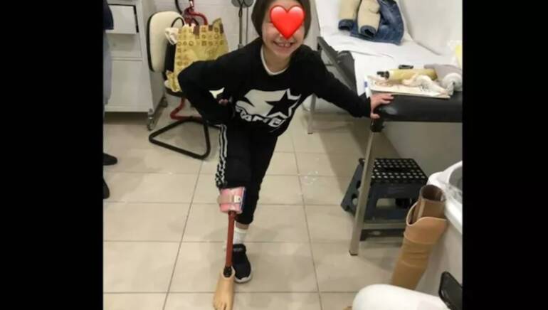 Solidarietà per Angela, la bimba di 7 anni che ha bisogno di protesi speciali. Per lei una raccolta fondi 