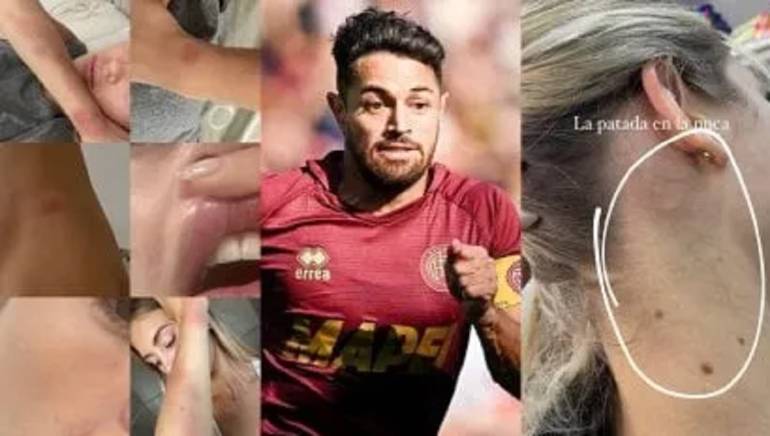 Il calciatore argentino Acosta accusato di violenza: il grido d’aiuto della ex moglie sui social
