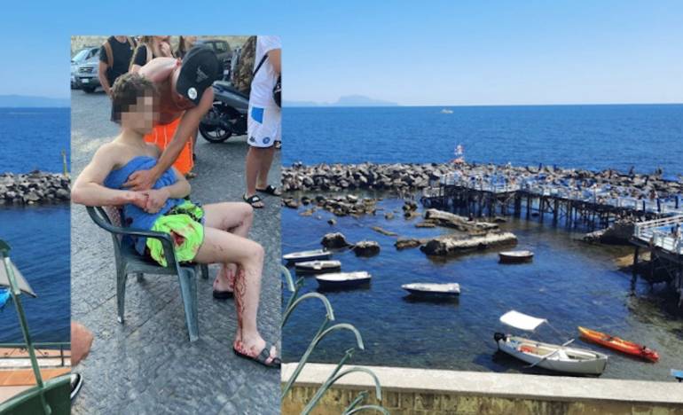 Napoli, bagnino accoltellato a Marechiaro: fermato un 16enne