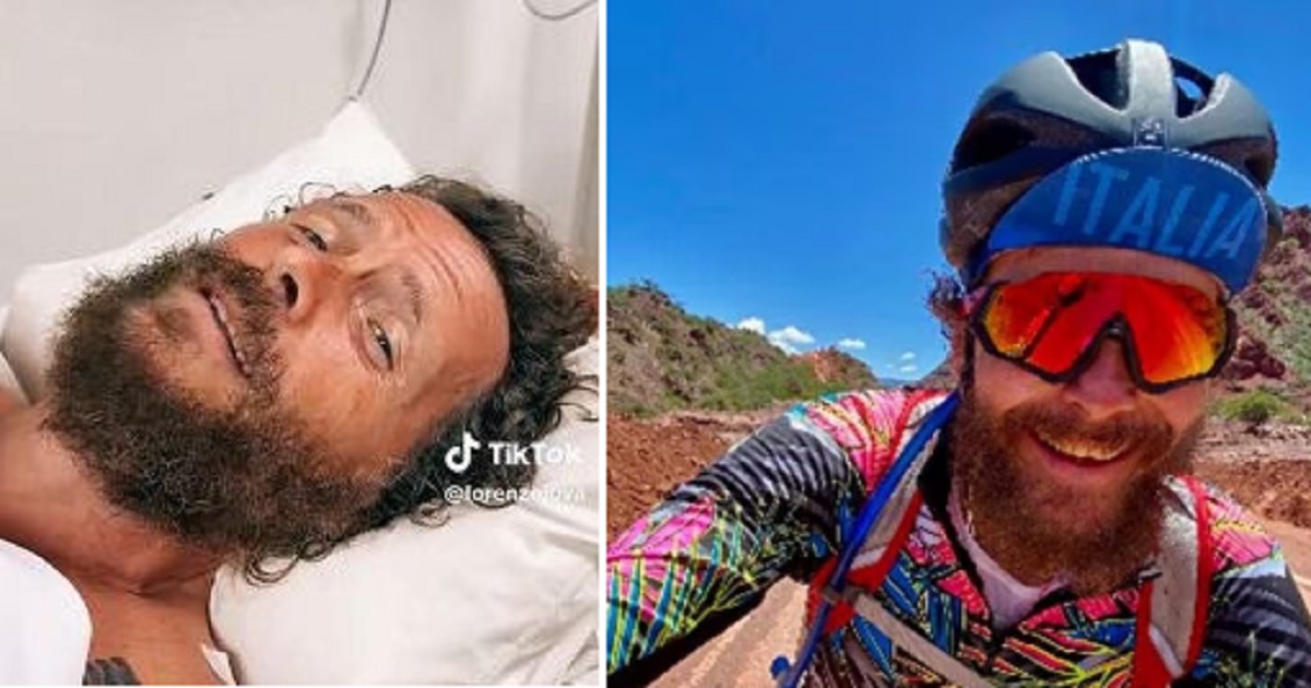 Incidente in bici per Jovanotti: ricoverato in ospedale con fratture, ma non è grave