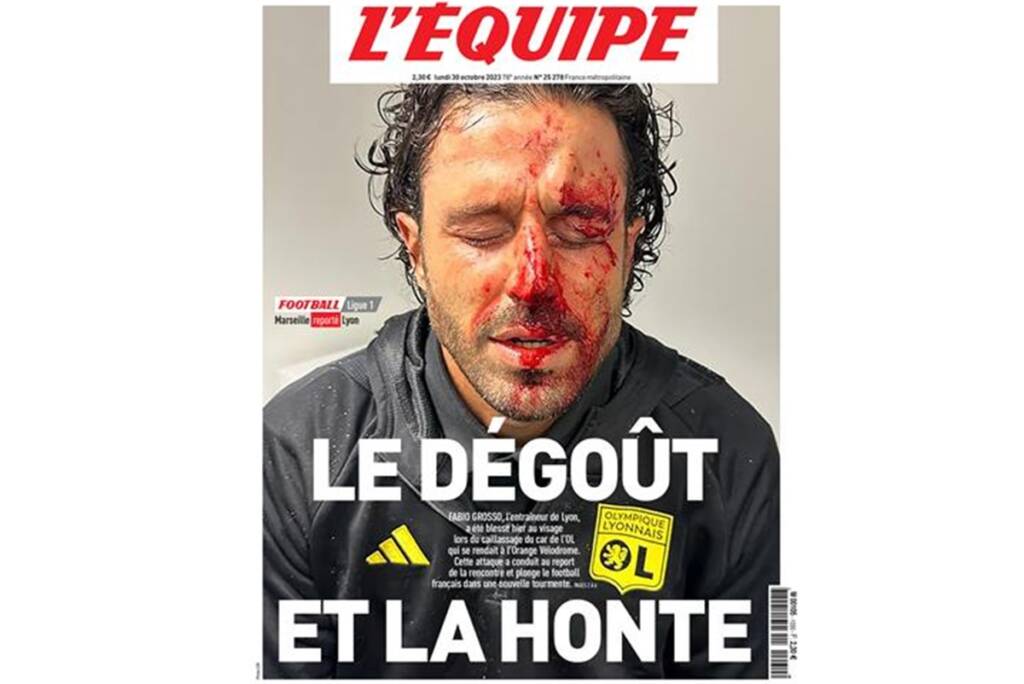 La faccia insanguinata di Grosso su tutti i giornali d’Europa