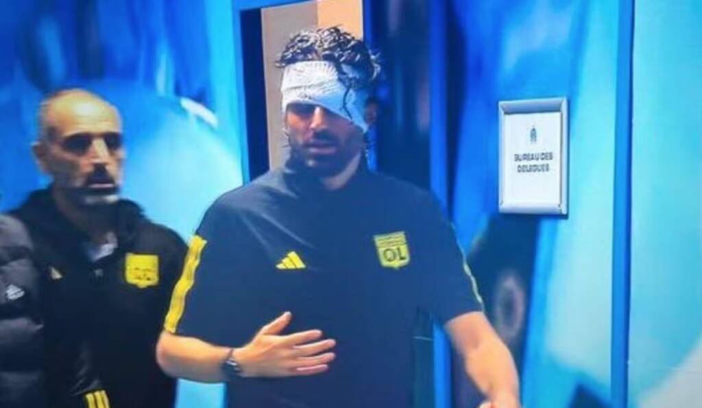 Vergogna a Marsiglia: sassi contro bus del Lione, Grosso ferito al volto. Partita rinviata