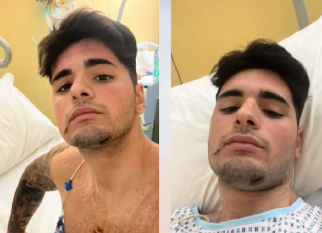 Pozzuoli, si sveglia dal coma il giovane accoltellato in discoteca e lancia un appello social