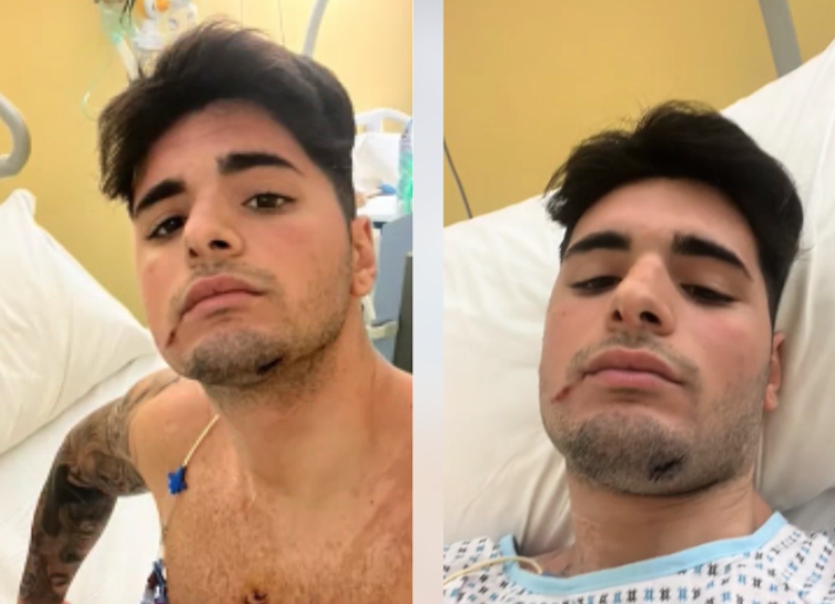 Pozzuoli: giovane accoltellato in discoteca si sveglia dal coma e lancia appello sui social media