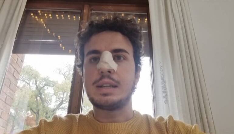 prof napoletano picchiato scuola