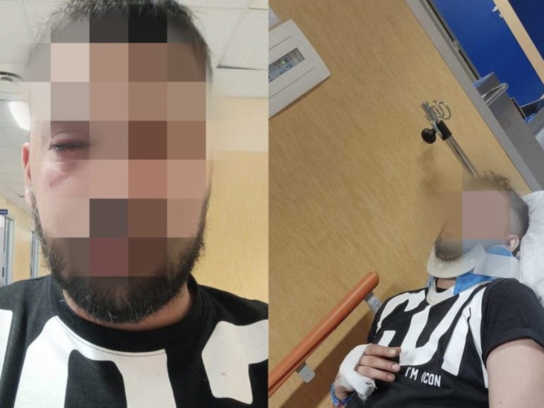 Napoli, a Marechiaro massacrato di botte dal parcheggiatore abusivo