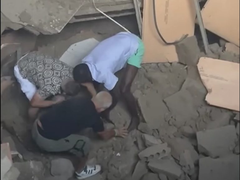 forcella gravi ustionati