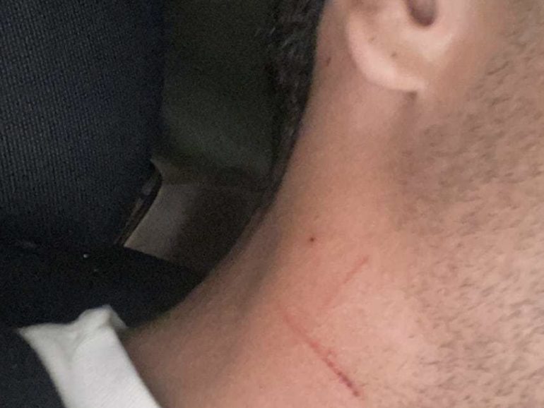Torre Annunziata, corriere aggredito in pieno giorno