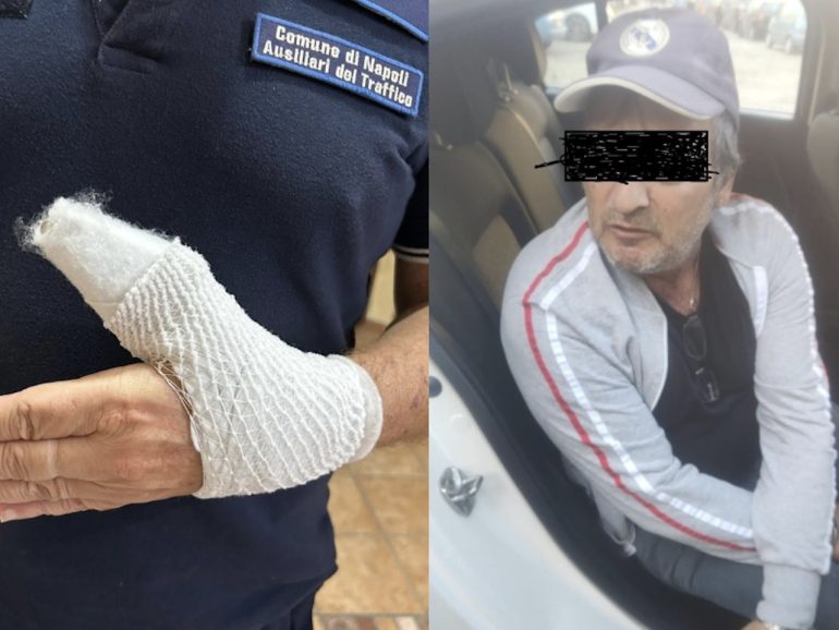 Napoli, ausiliario del traffico aggredito a Fuorigrotta da parcheggiatore abusivo finisce in ospedale