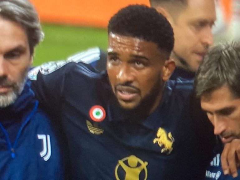 Juve, che tegola: lesione del legamento crociato per Bremer. Stagione finita