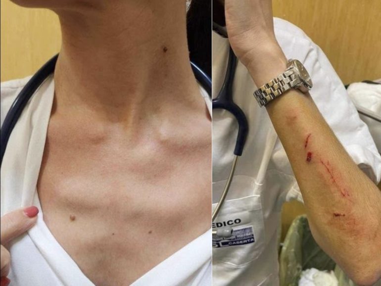 Aversa, dottoressa aggredita al pronto soccorso dell’ospedale Moscati
