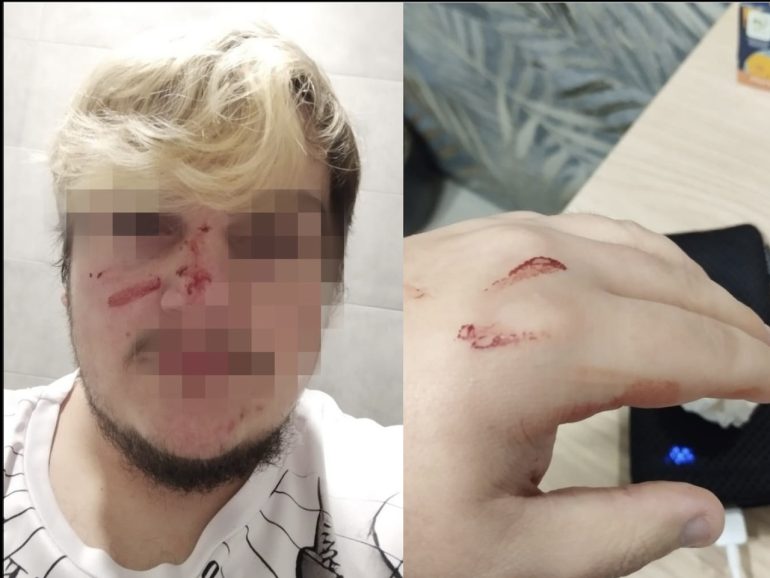 Bacoli, ragazzo picchiato