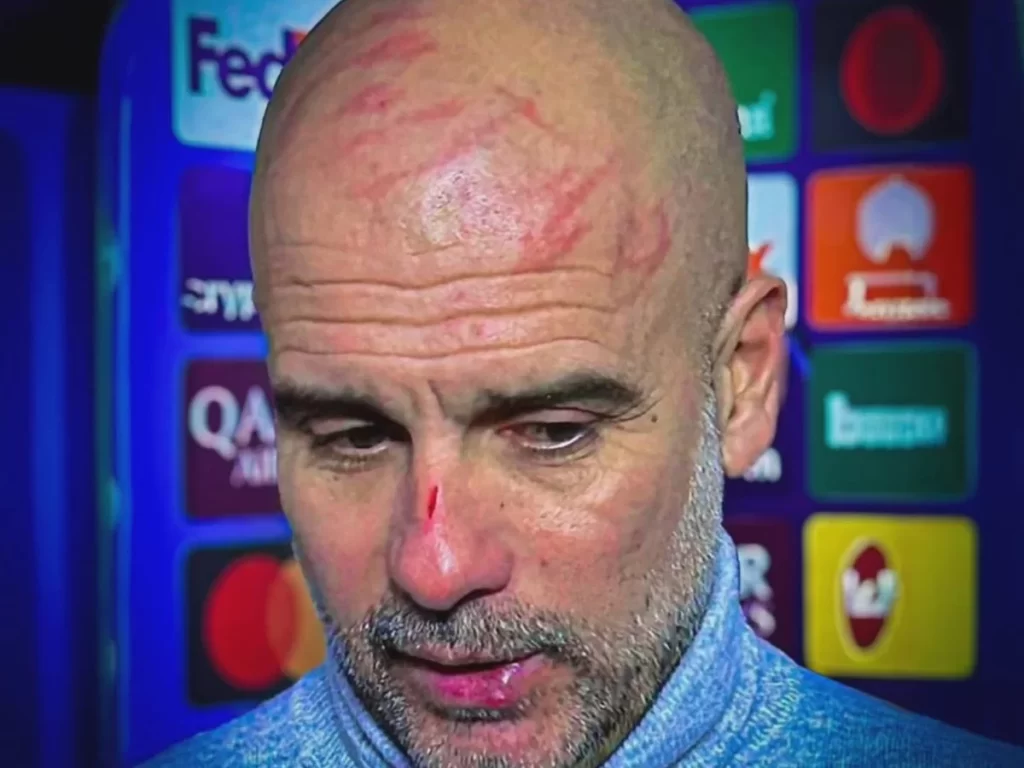 Guardiola, graffi sul viso e preoccupazione tra gli psicologi: “C’è il rischio emulazione”