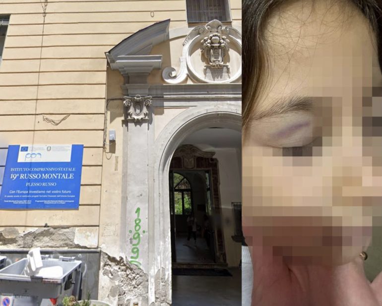 Napoli, bullismo a scuola: bambina aggredita in classe al rione Stella