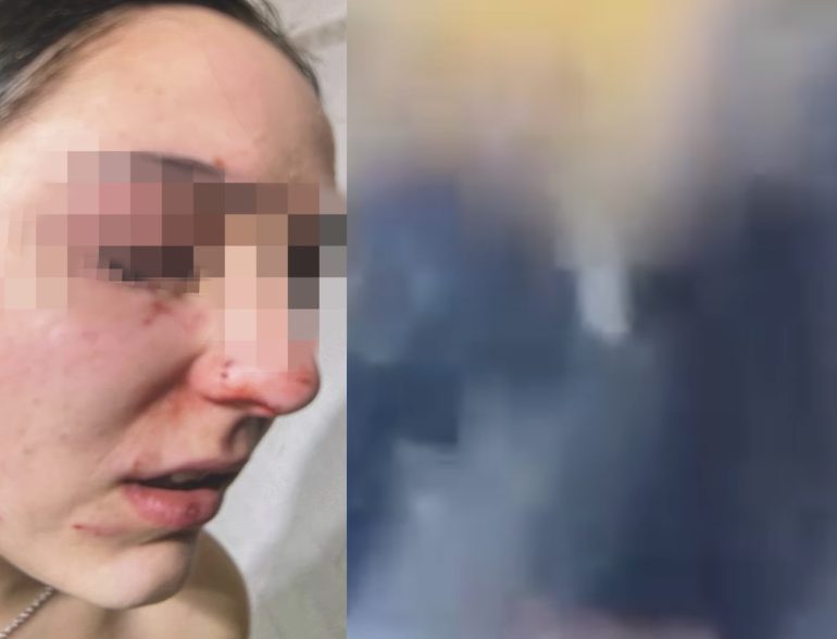 Marano, studentessa aggredita e filmata dai compagni di classe