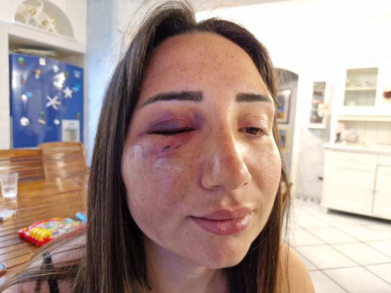 Pozzuoli, tentato omicidio di Gaia Caputo: l’ex resta in carcere. Caccia ai due complici