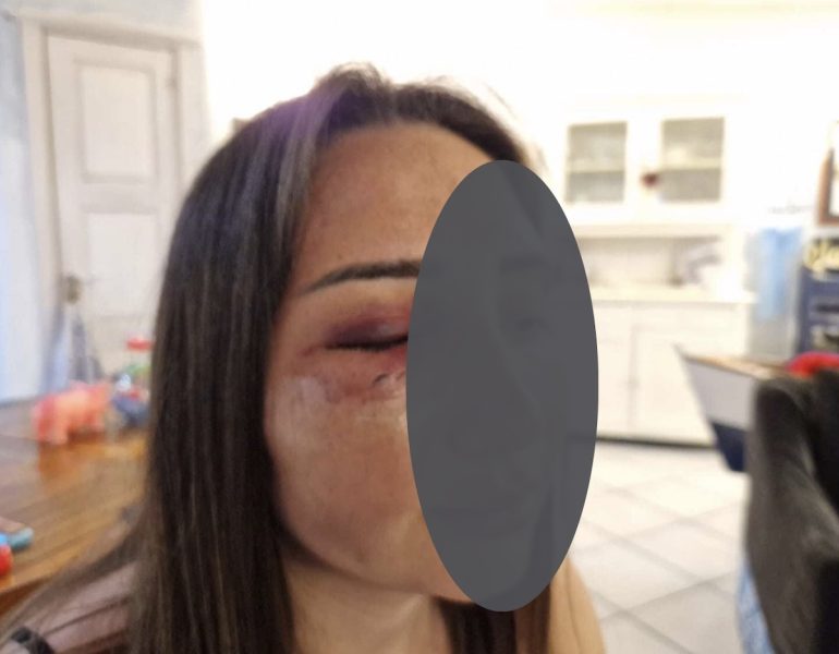 Pozzuoli, Gaia racconta il suo incubo: “Sono una sopravvissuta”