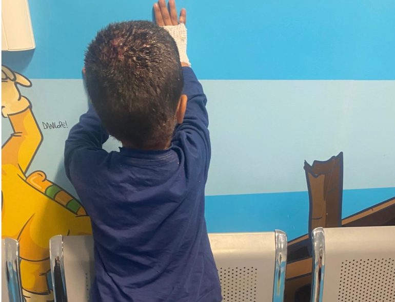 Bimbo di 2 anni da Gaza all’Ospedale Santobono di Napoli: “Qui per salvarlo”